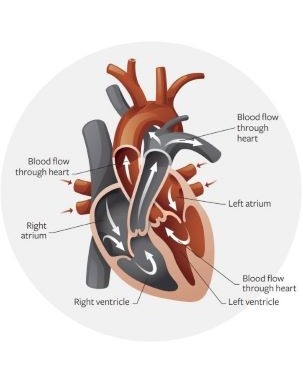 atrial fibrillation