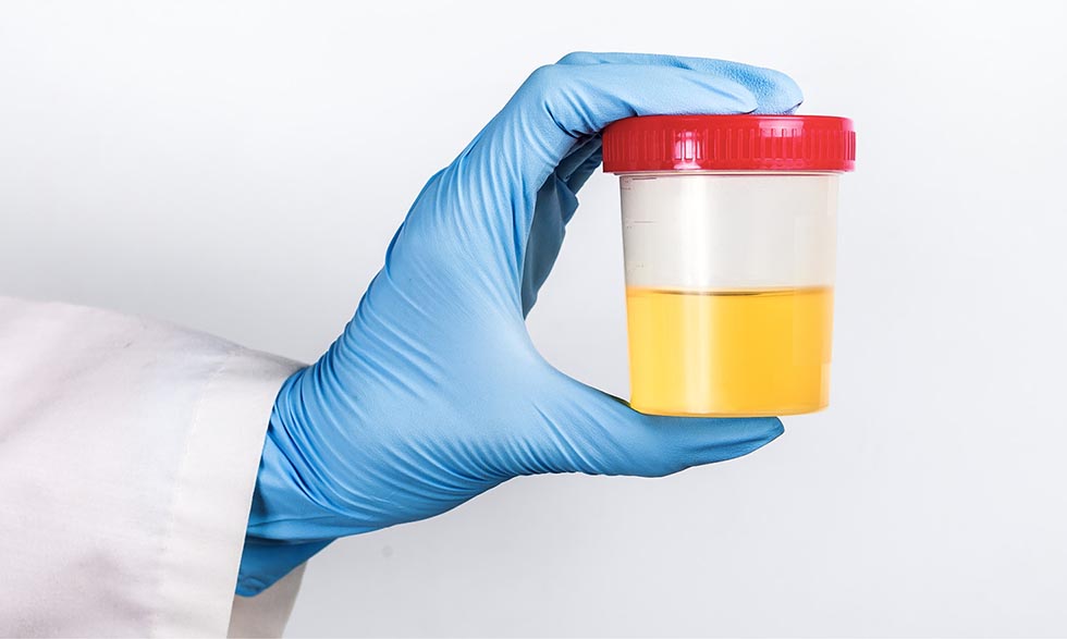 Researchers knew that urobilin was what makes your urine yellow, but they hadn’t discovered the enzyme that was key to this chemical process. 