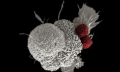 Shown here is a pseudo-colored scanning electron micrograph of an oral squamous cancer cell (white) being attacked by two cytotoxic T cells (red), part of a natural immune response.